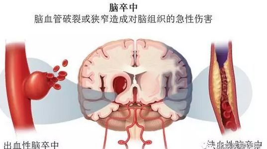 图片 10