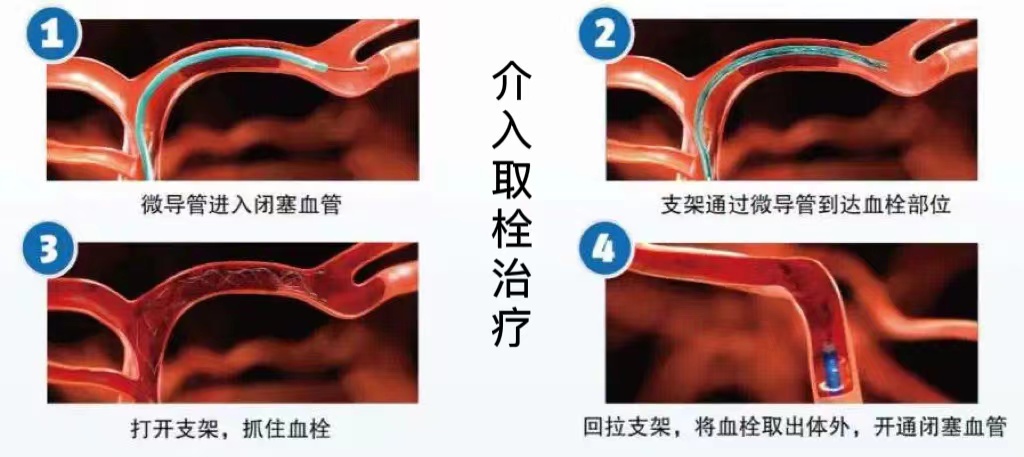 图片 22